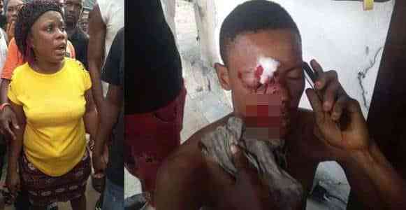 Lady stabs her boyfriend in the eye over a phone call in Rivers state