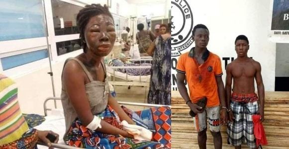 Nigerian Lady becomes blind after robbers raped and poured acid on her
