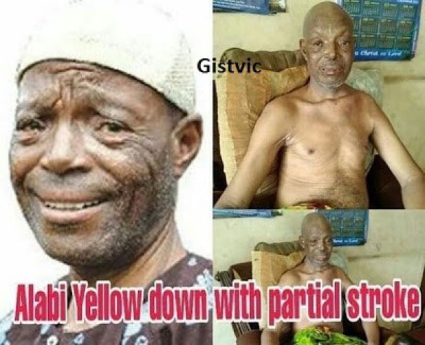 Veteran Yoruba Actor, Alabi Yellow, Dying Of Stroke (PHOTO)