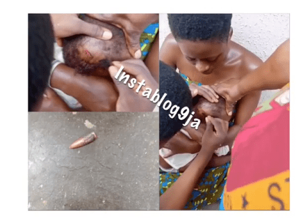 Baby Narrowly Escapes Death, As Stray Bullet Scrapes His Head, Today, in PH, Rivers State