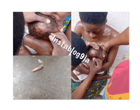 Baby Narrowly Escapes Death, As Stray Bullet Scrapes His Head, Today, in PH, Rivers State