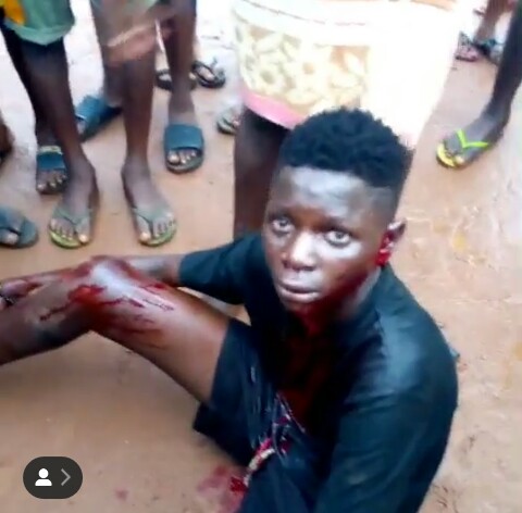 The teenage boy beaten to a pulp