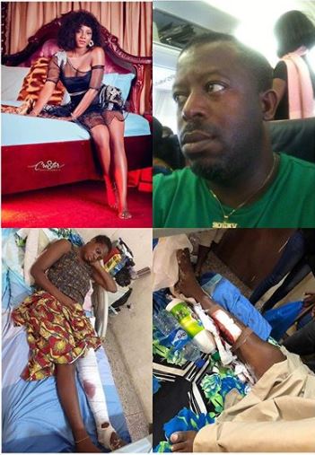 Seigha Atia's leg amputated after being rammed by her ex's car.