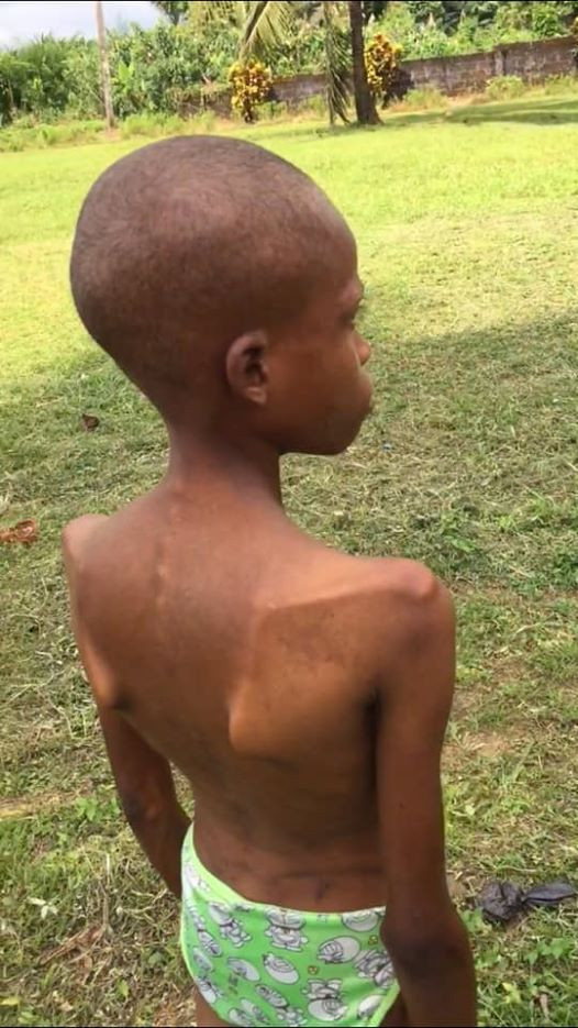  13-year-old girl allegedly locked up in toilet, tortured, starved by her mother for years in Akwa Ibom after prophet claimed she was possessed by demon (photos)
