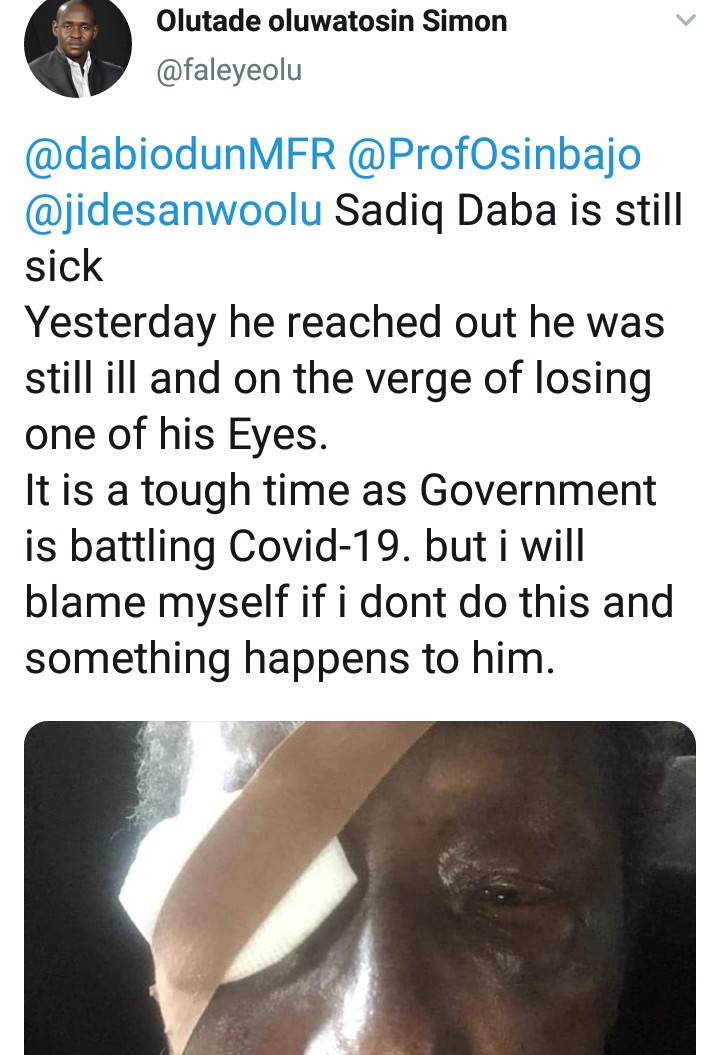 Veteran Nollywood actor Sadiq Daba is "on the verge of losing one of his eyes" as his health worsens, journalist claims