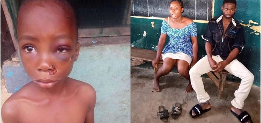 Couple arrested for inflicting severe injuries on their 8 year old son for buying N100 worth of Akara instead of N50