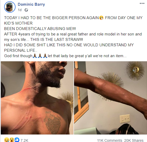 Man accuses his baby mama of beating him up over "jealousy, lies and envy"