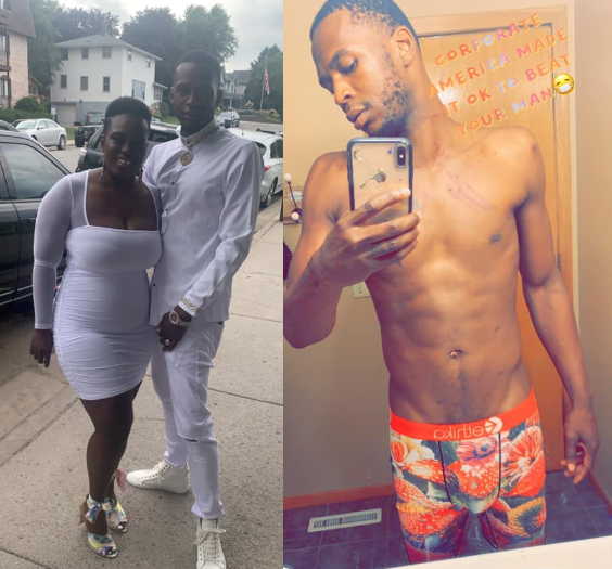 Man accuses his baby mama of beating him up over "jealousy, lies and envy"