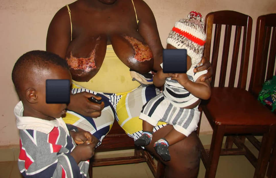 Ghanaian man pours hot water on his breastfeeding wife