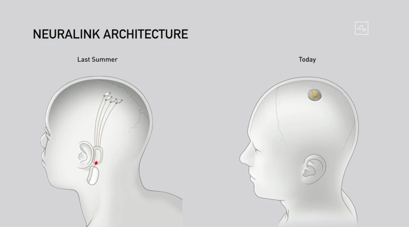 Elon Musk's Neuralink Launches Brain-Monitoring Implant, Demonstrates How It Works Using Pigs 2