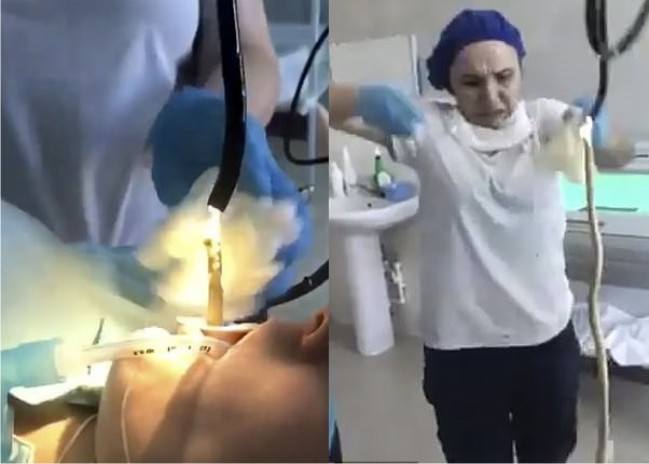Shocking Moment Doctors pulled out a 4 feet snake from a woman's throat - Video 1