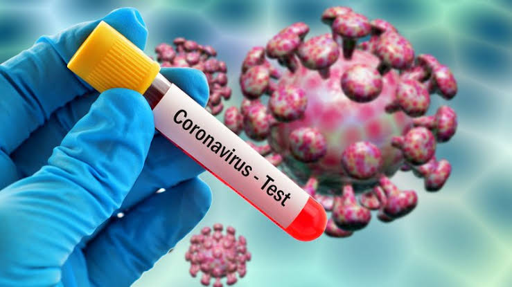 "36 In Lagos, 35 In Abuja" - Nigeria Records 156 New Coronavirus Cases As Total Rises To 54,743 1