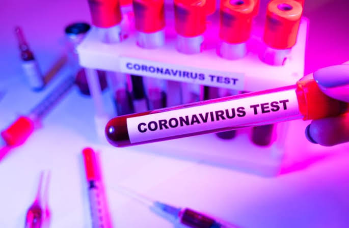 "37 In Abuja, 27 In Lagos" - Nigeria Records 126 New Coronavirus Cases As Total Rises To 56,604 1