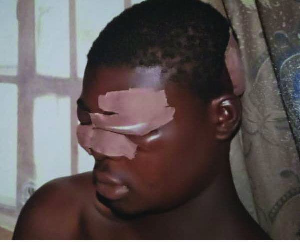 Ibidokun at the hospital after getting blinded