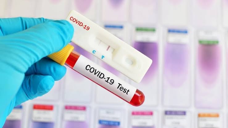 "85 In Lagos, 72 In Oyo" - Nigeria Confirms 212 New Cases Of Coronavirus As Total Hits 61,194 1