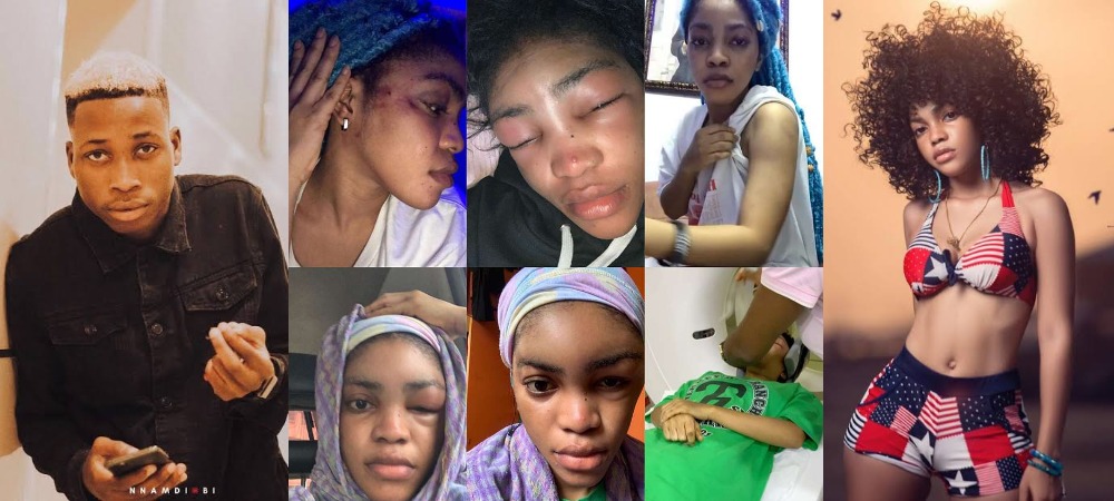 Davido’s Artist, Lil Frosh Accused Of Beating His Girlfriend To Pulp, Recording Her Nakedness [Photos/Video] 1