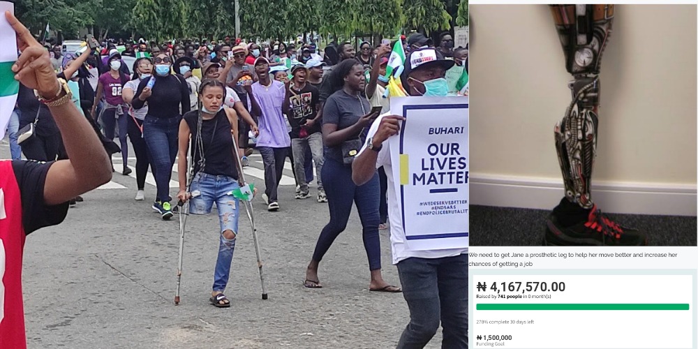 Nigerians Raise Over N4m For #EndSARS Protester In Need Of N1.5m Prosthetic Leg 1