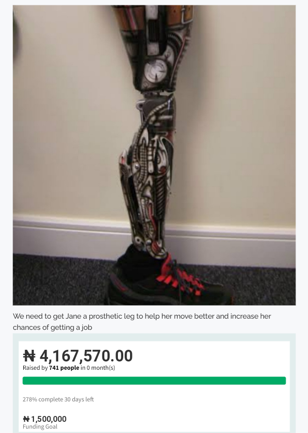 Nigerians Raise Over N4m For #EndSARS Protester In Need Of N1.5m Prosthetic Leg 2