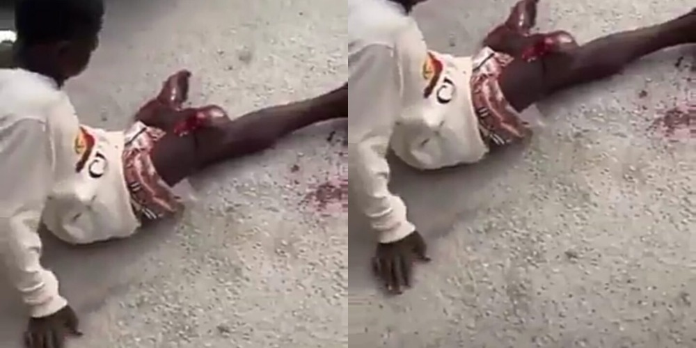 Police Allegedly Shoots Young Boy On His Leg During #EndSARS Protest In Delta [Video] 1