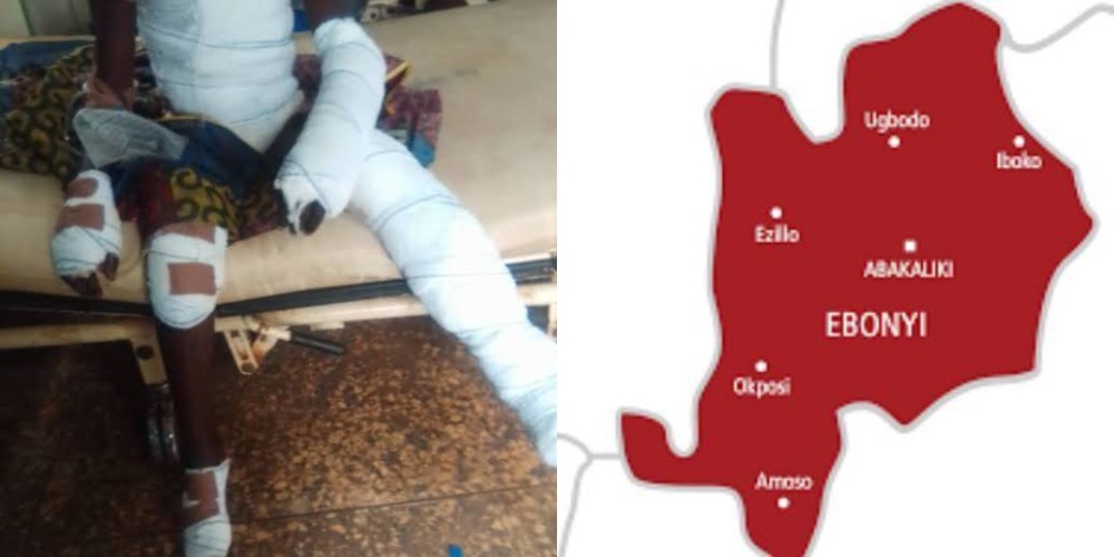 10-Year-Old Boy Tied Up And Thrown Into Fire For Allegedly Stealing Uncooked Rice In Ebonyi 1