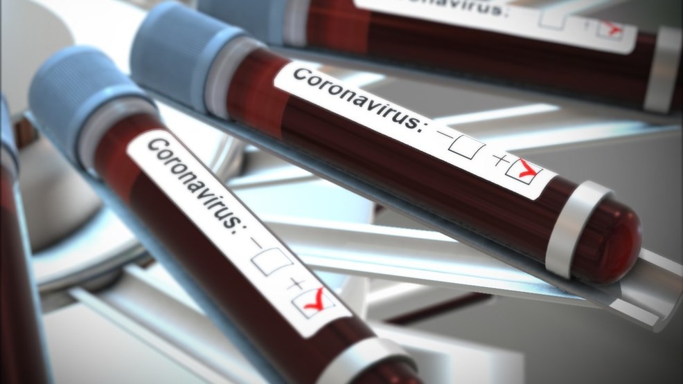"74 In Kaduna, 42 In Abuja" - Nigeria Records 169 New Coronavirus Cases As Total Rises To 66974 1