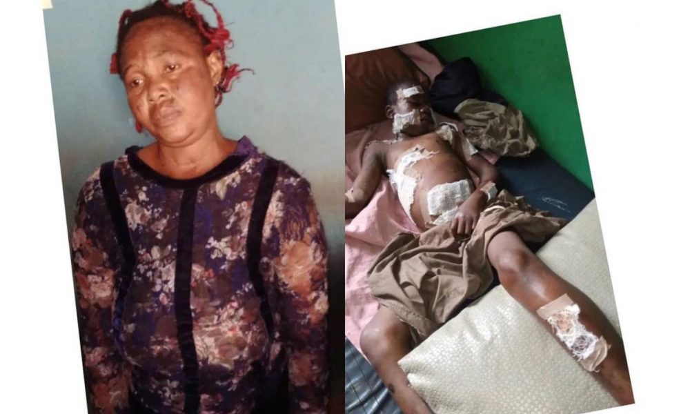 Lady Uses Hot Knife To Inflict Injuries On Her 12-Yr-Old In-Law Over  Missing N5,00