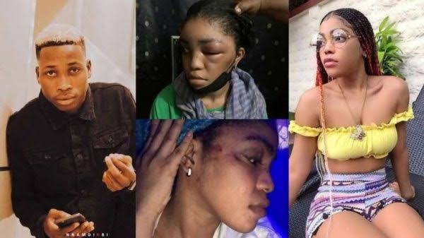 Lil Frosh’s Girlfriend, Gift Camille Reacts After He Denied Beating Her Up Beyond Recognition 1