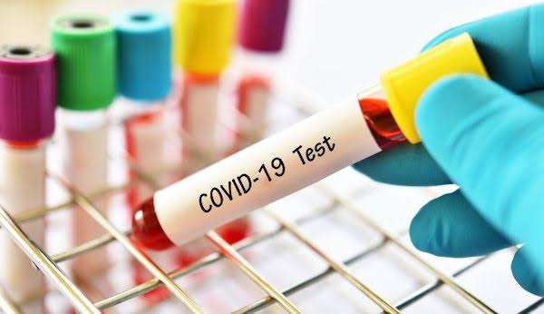 "37 In Kaduna, 29 In Lagos" - Nigeria Records 122 New Coronavirus Cases As Total Rises To 67,960 1