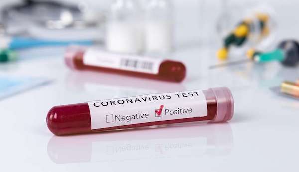 "90 In Ondo, 89 In Kwara" - Nigeria Records 506 New Coronavirus Cases As Total Hits 139,748 1