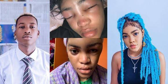 Lil Frosh Reported Arrested And Detained For Beating Up His Girlfriend, Gift Camille 1