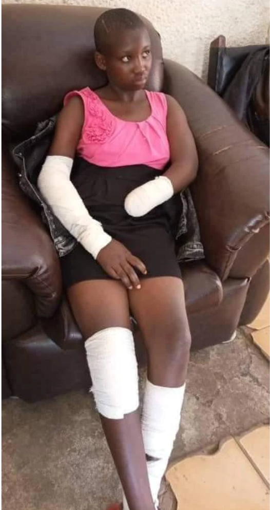 "He Ordered Me To Undress And I Refused" - Young Girl Narrates How Rapist Cut Off Her Hand 1