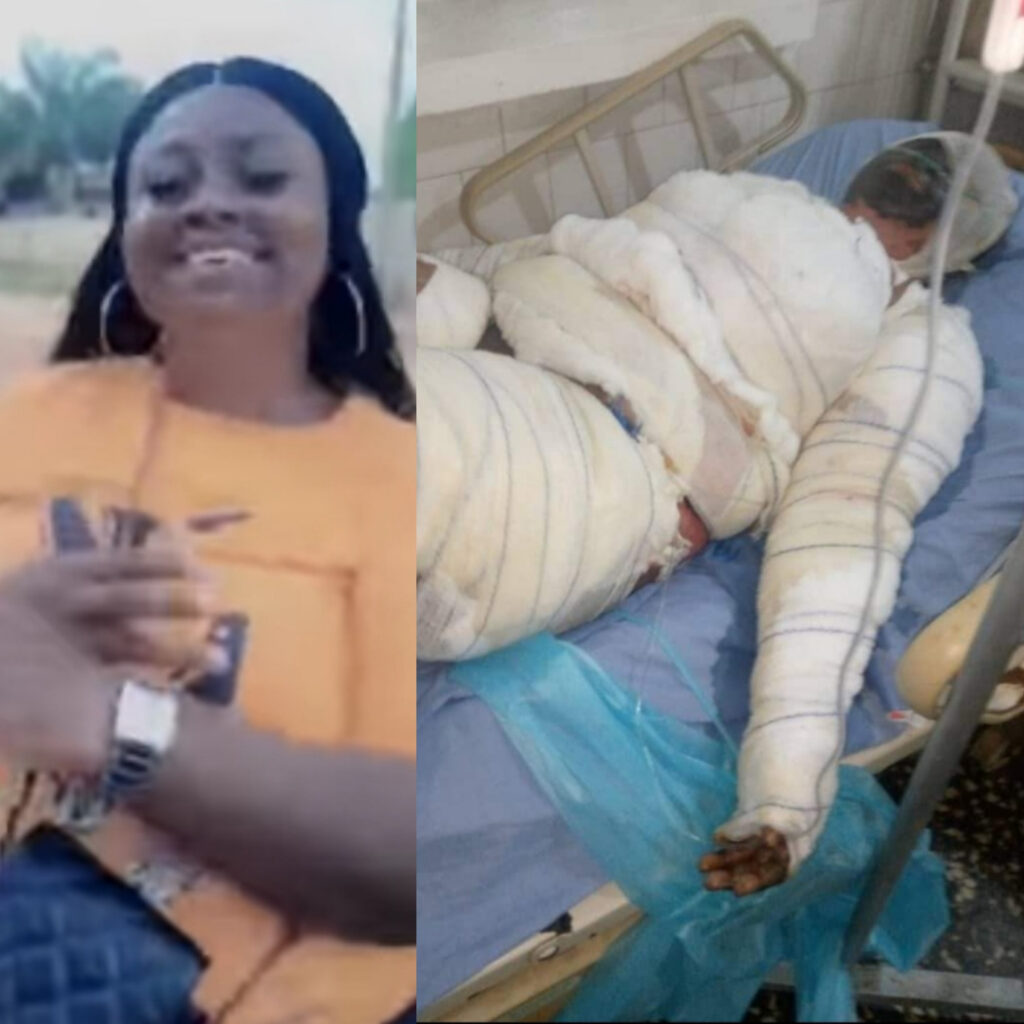 Woman Dies After She Was Set Ablaze By Husband Because She Travelled For Her Mother's Burial