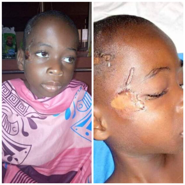 Oh No! Little Boy Severely Abused, Beaten And Left N*ked In Bush In Akwa Ibom (Photos)