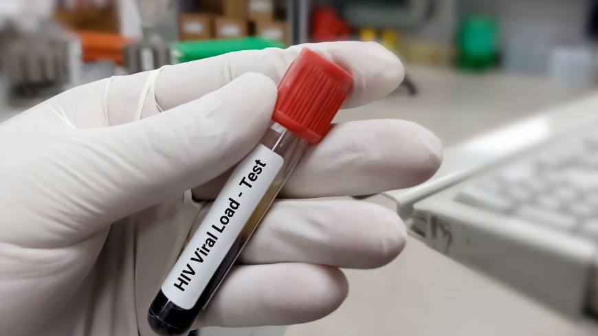 New York Patient Becomes First Woman To Be Cured Of HIV Using Novel Treatment