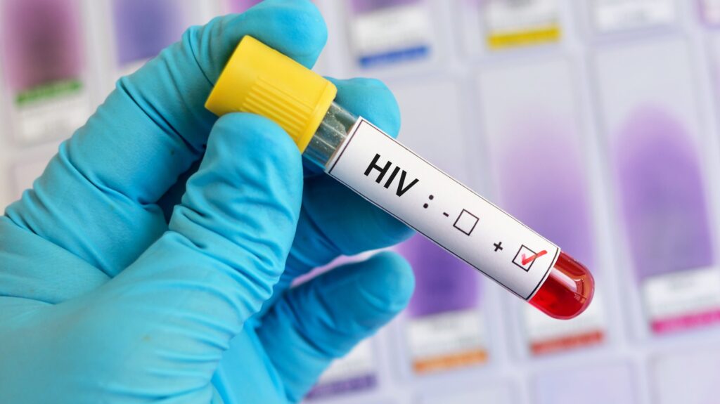 Scientists Discover New ‘Highly Transmissible’ Strain Of HIV Variant In Netherlands