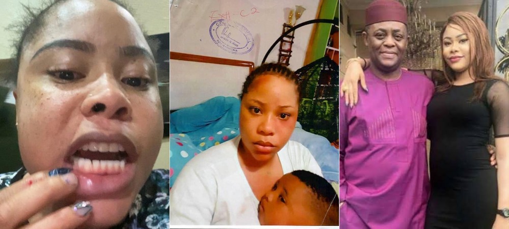 Fani-Kayode’s Ex-Wife, Precious Chikwendu Releases ‘Evidence’ Of Domestic Abuse [Photos]