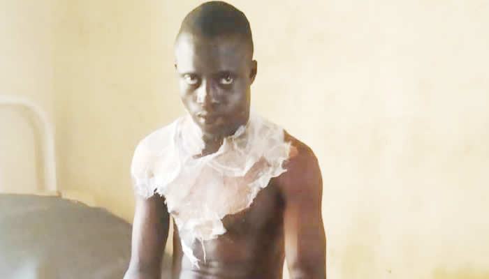 Newly Married Man Burns Himself In Suicide Attempt, Blames Abusive Wife In Osun