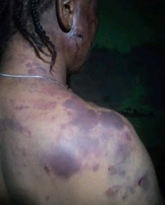 Man Allegedly Beats His Wife To Pulp, Dumps Her Over Disagreement With His Girlfriend In Rivers