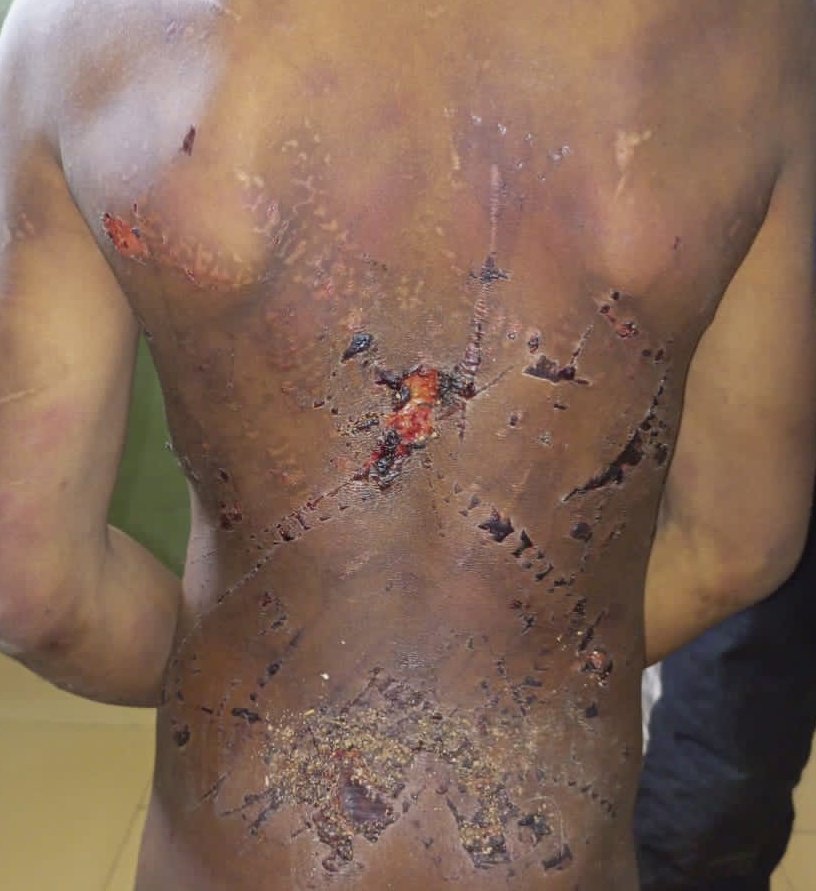 Police Arrest Couple For Assaulting 11-year-old Nephew In Adamawa