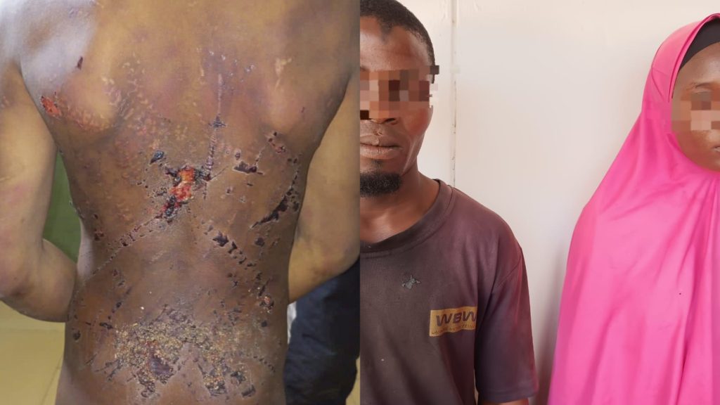 Police Arrest Couple For Assaulting 11-year-old Nephew In Adamawa