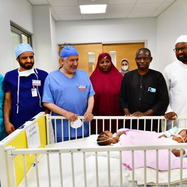 Saudi Medical Team Separates Kano Conjoined Twins (Photo)
